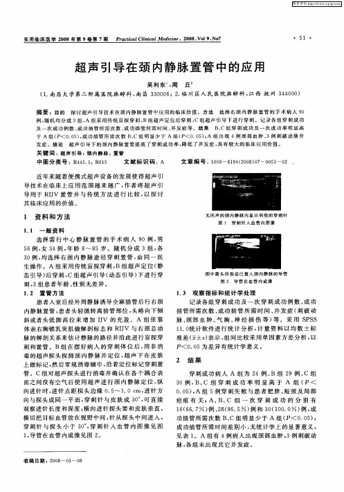 超声引导在颈内静脉置管中的应用