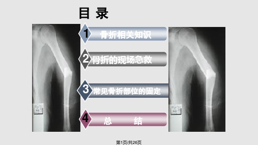 骨折病人急救护理PPT课件