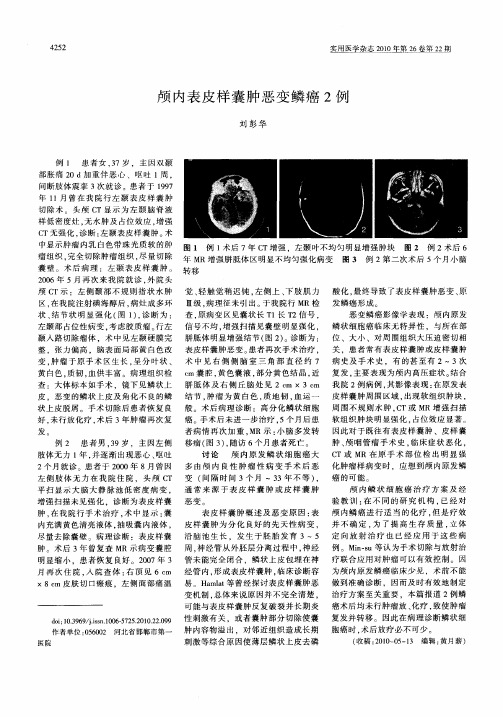 颅内表皮样囊肿恶变鳞癌2例