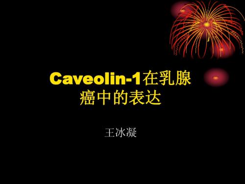 Caveolin1在乳腺癌中的表达