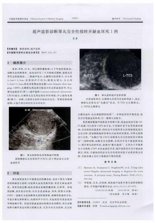 超声造影诊断睾丸完全性扭转并缺血坏死1例