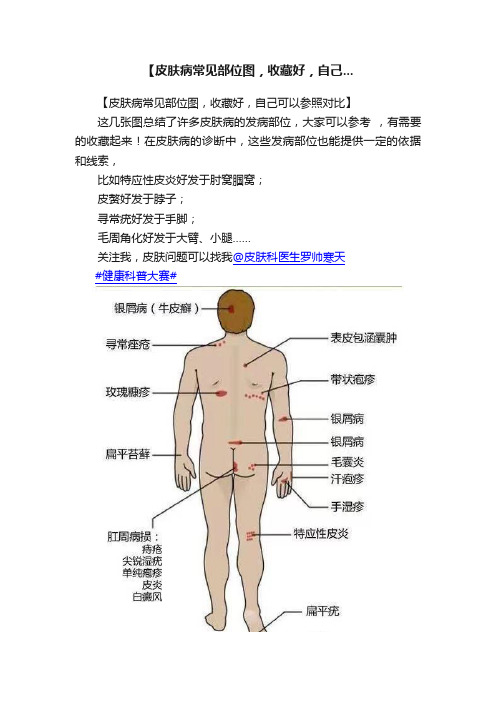 【皮肤病常见部位图，收藏好，自己...