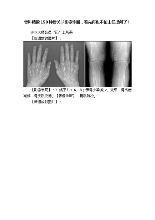 骨科精读150种骨关节影像诊断，看完再也不怕主任提问了！