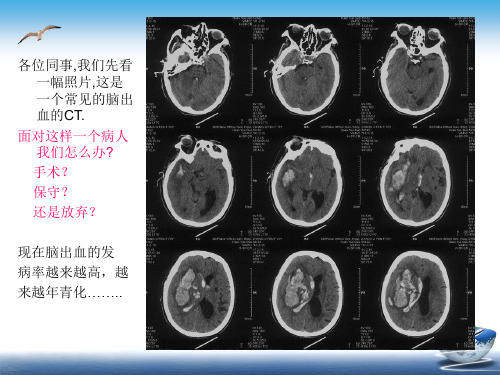 高血压脑出血的治疗课件