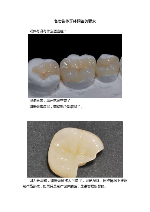 各类嵌体牙体预备的要求