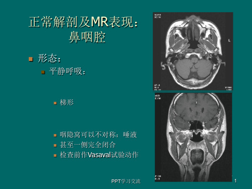 鼻咽癌MR诊断2018ppt课件