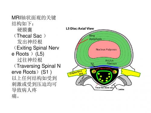 椎间盘的磁共振诊断课件