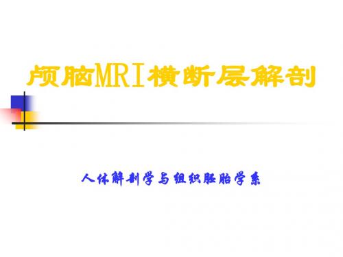 颅脑MRI横断层解剖PPT课件 共22页PPT资料