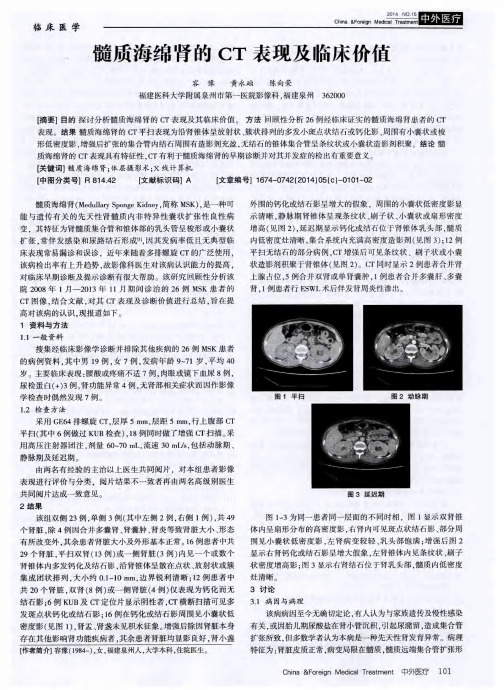 髓质海绵肾的CT表现及临床价值