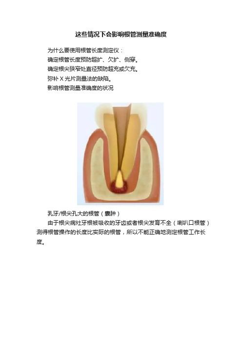 这些情况下会影响根管测量准确度