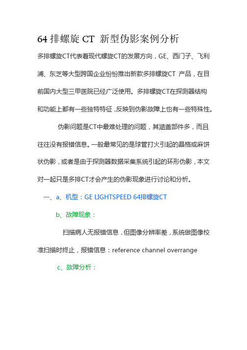 64排螺旋CT 新型伪影案例分析