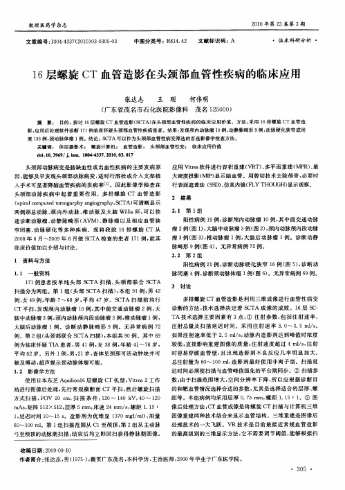 16层螺旋CT血管造影在头颈部血管性疾病的临床应用