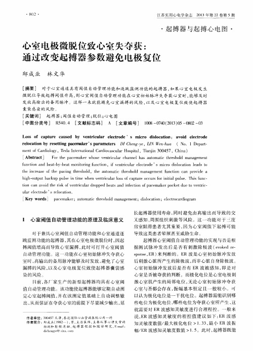 心室电极微脱位致心室失夺获：通过改变起搏器参数避免电极复位