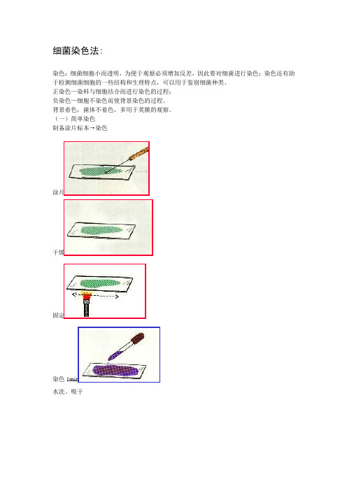 细菌染色法