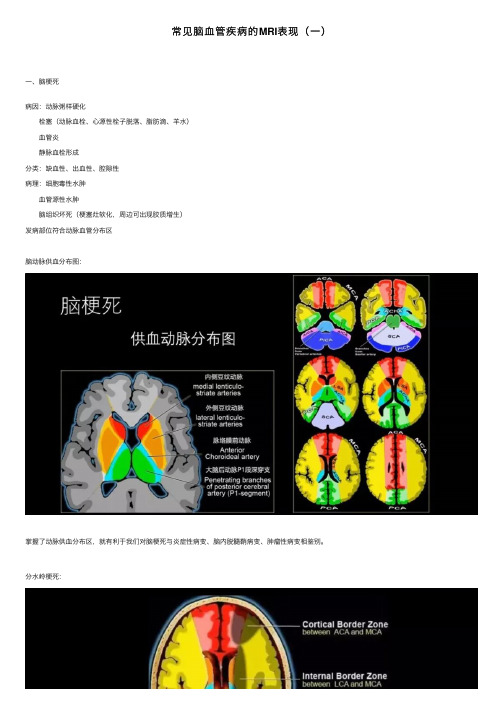 常见脑血管疾病的MRI表现（一）