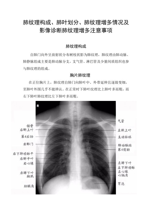 肺纹理构成、肺叶划分、肺纹理增多情况及影像诊断肺纹理增多注意事项