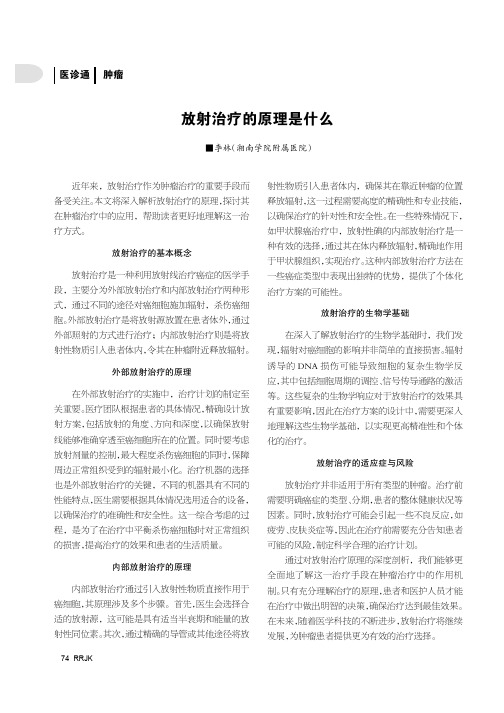 放射治疗的原理是什么