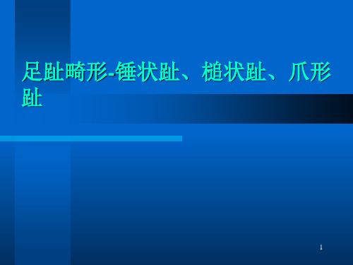 足趾畸形-锤状趾、槌状趾、爪形趾参考PPT