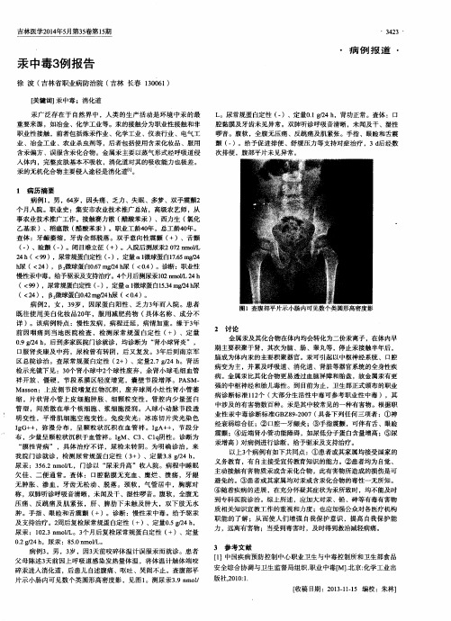 汞中毒3例报告