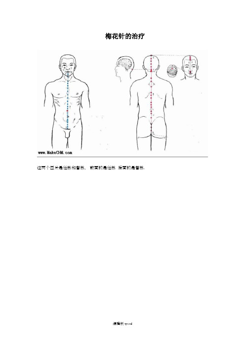 梅花针治疗