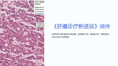 《肝癌诊疗新进展》课件