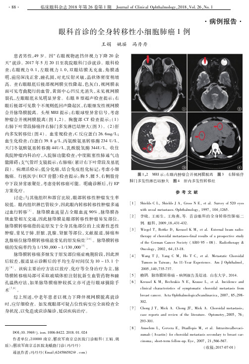 眼科首诊的全身转移性小细胞肺癌1例