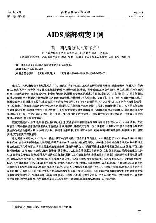 AIDS脑部病变1例