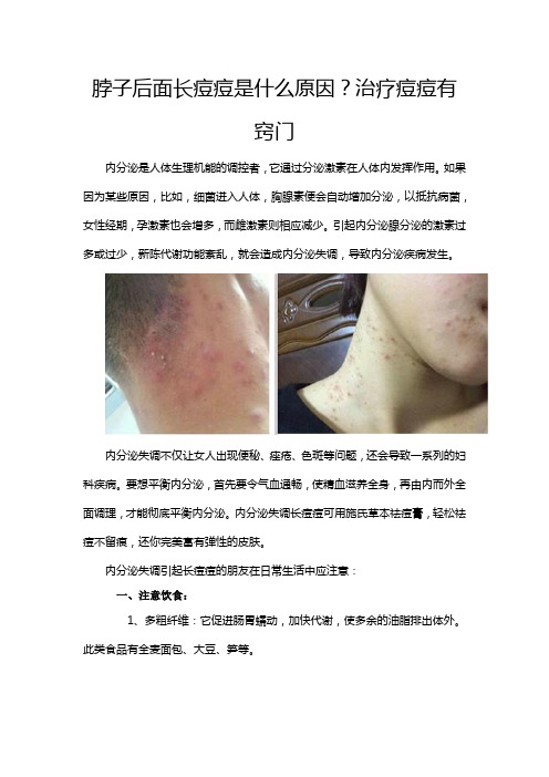 脖子后面长痘痘是什么原因？治疗痘痘有窍门