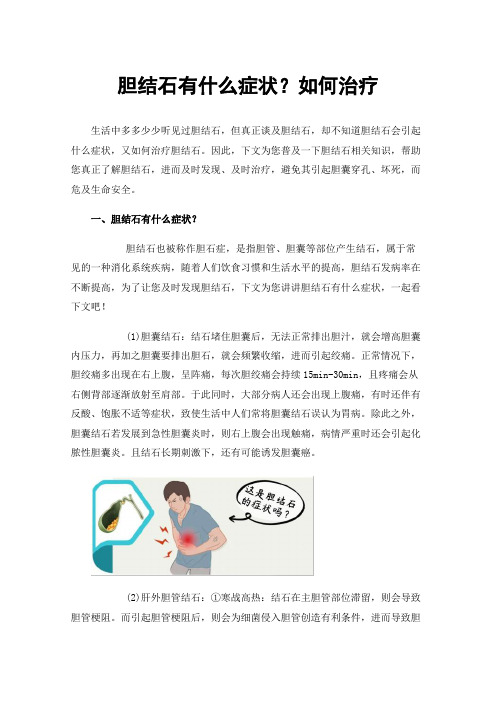 胆结石有什么症状？如何治疗