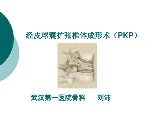 球囊扩张椎体成形PKP