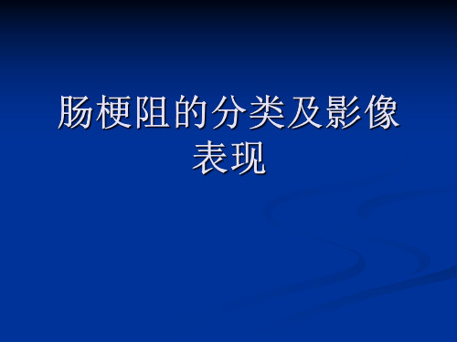 医学影像-肠梗阻的分类及影像表现