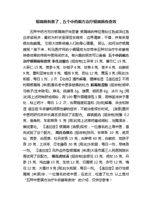 银屑病有救了，五个中药偏方治疗银屑病有奇效