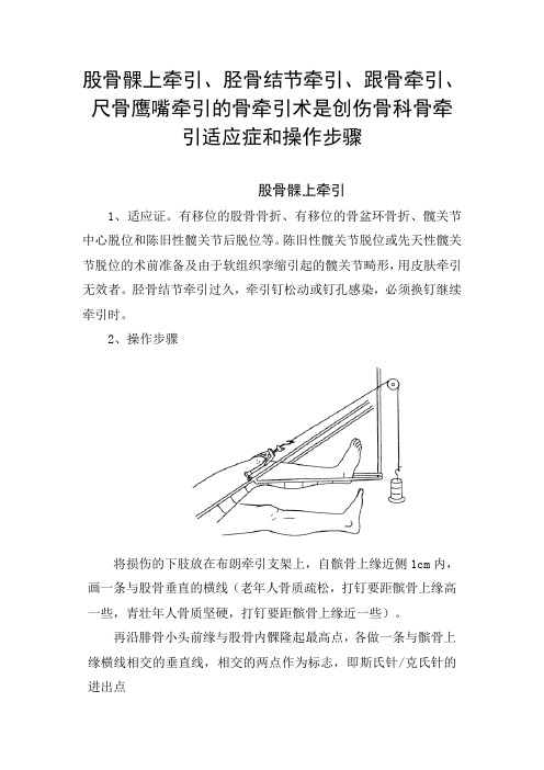 股骨髁上牵引、胫骨结节牵引、跟骨牵引、尺骨鹰嘴牵引的骨牵引术是创伤骨科骨牵引适应症和操作步骤