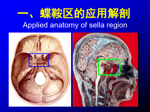 医学影像-蝶鞍区断层解剖与影像对照