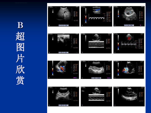 解读B超报告基础知识ppt课件