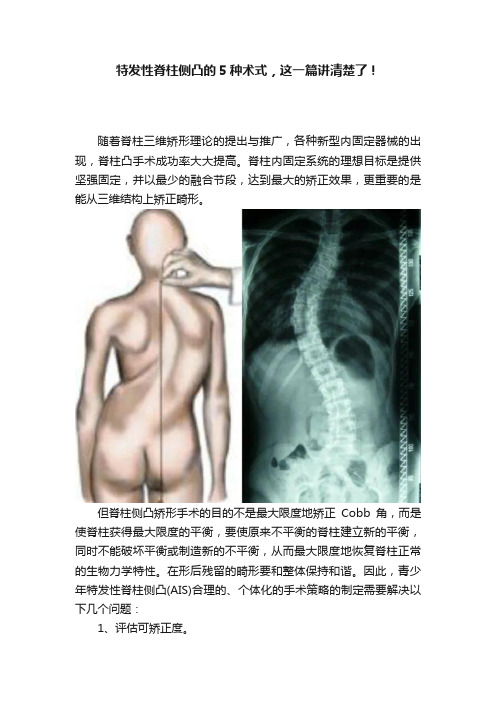 特发性脊柱侧凸的5种术式，这一篇讲清楚了！