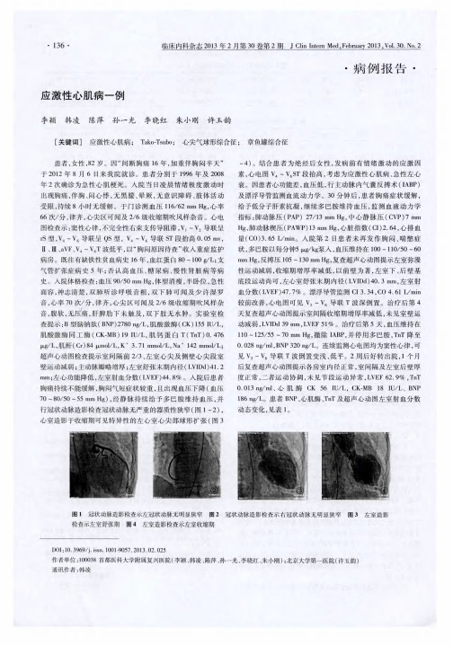 应激性心肌病一例