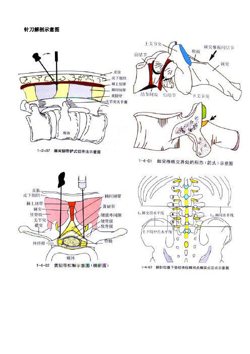 针刀解剖示意图