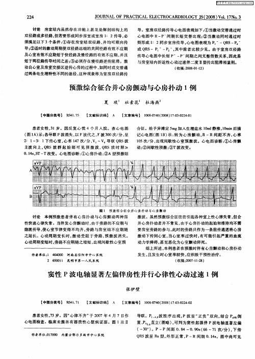 窦性P波电轴显著左偏伴房性并行心律性心动过速1例