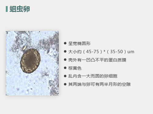 寄生虫学虫卵总结及图片