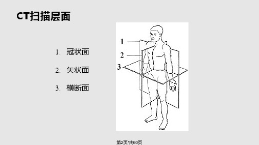 脑部CT讲座学习