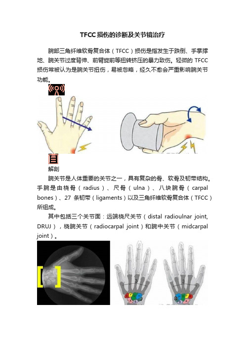 TFCC损伤的诊断及关节镜治疗