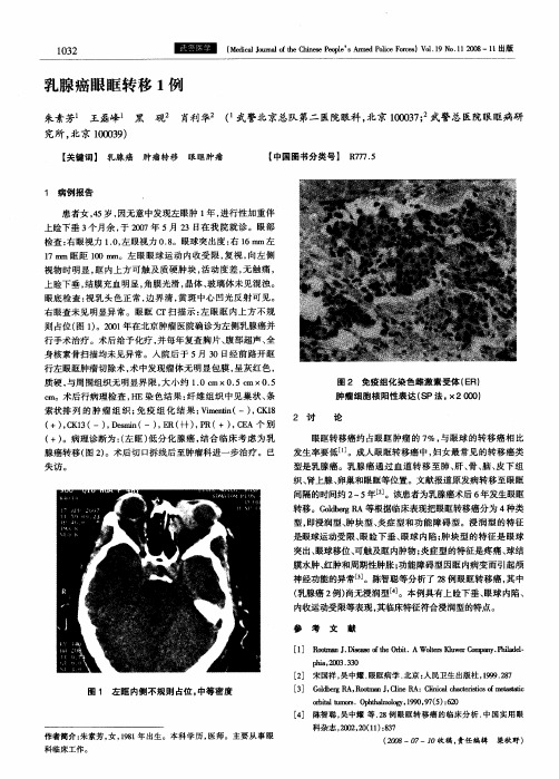 乳腺癌眼眶转移1例