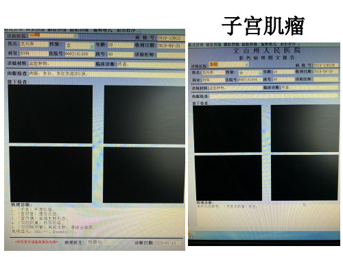 2020-07-15影像读片