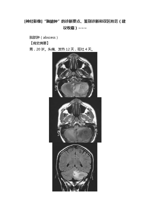 [神经影像]“脑脓肿”的诊断要点、鉴别诊断和误区防范（建议收藏）~~~