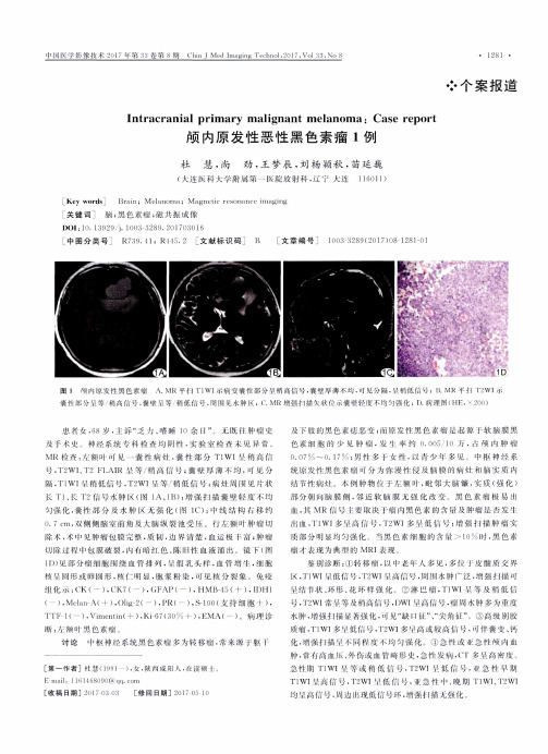 颅内原发性恶性黑色素瘤1例