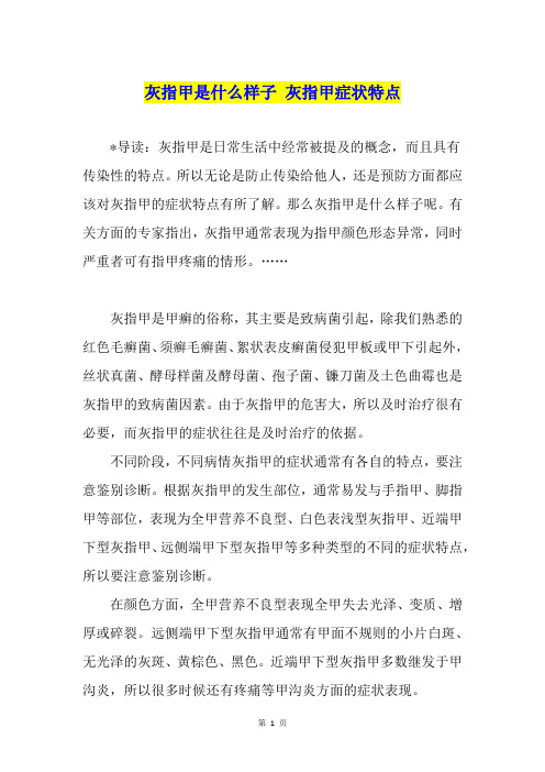 灰指甲是什么样子 灰指甲症状特点