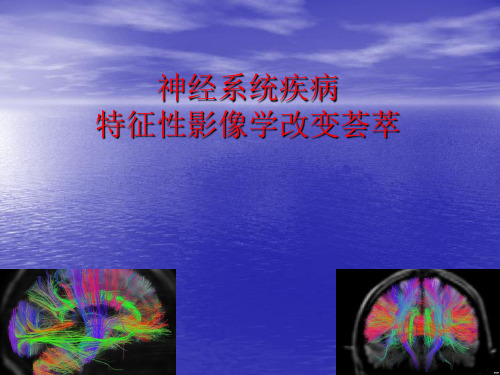 神经系统疾病的特异性影像学荟萃