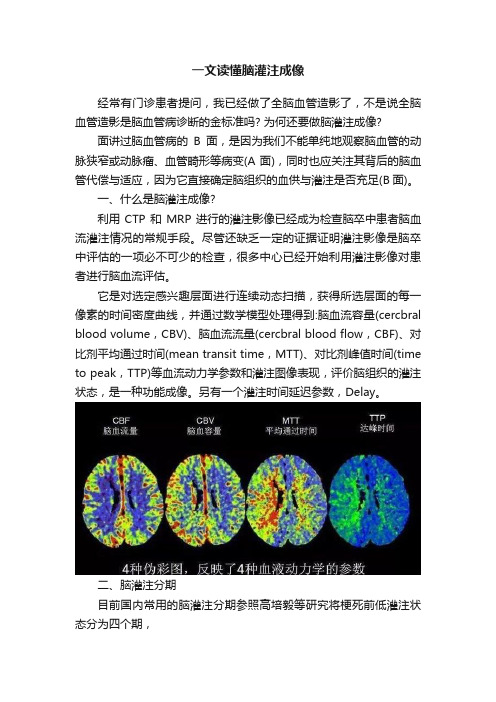 一文读懂脑灌注成像