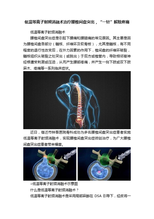 低温等离子射频消融术治疗腰椎间盘突出，“一针”解除疼痛